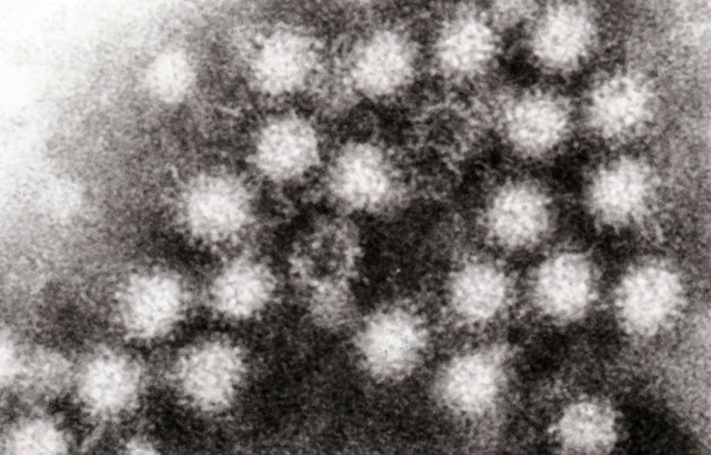 Austin Faces Rising Norovirus Cases Amid National Increase, Local Doctor Confirms