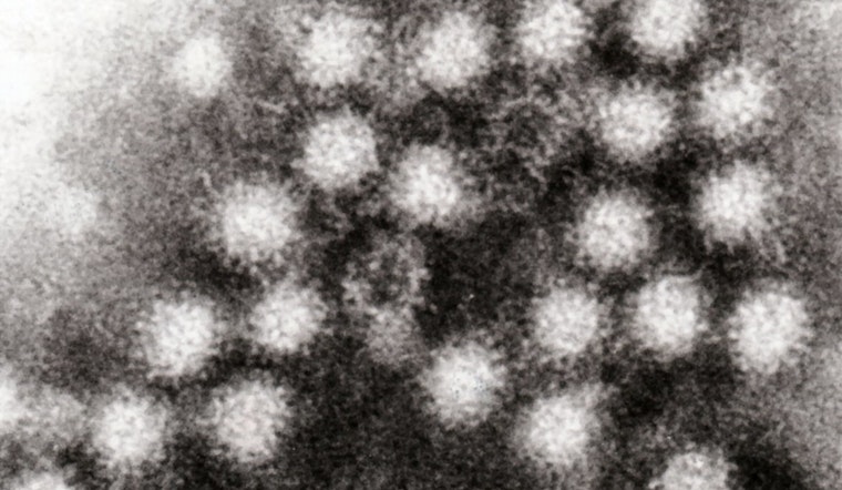 Austin Faces Rising Norovirus Cases Amid National Increase, Local Doctor Confirms