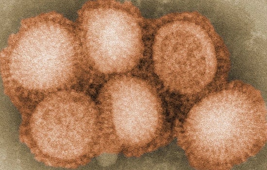 Low Levels of H5 Avian Influenza Detected in Kauaʻi Wastewater, DOH Advises Heightened Biosecurity