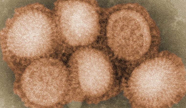 Low Levels of H5 Avian Influenza Detected in Kauaʻi Wastewater, DOH Advises Heightened Biosecurity