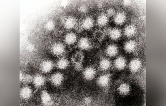 Milwaukee Battles Surge in Respiratory Illnesses, Norovirus and Whooping Cough Add to Winter Health Concerns
