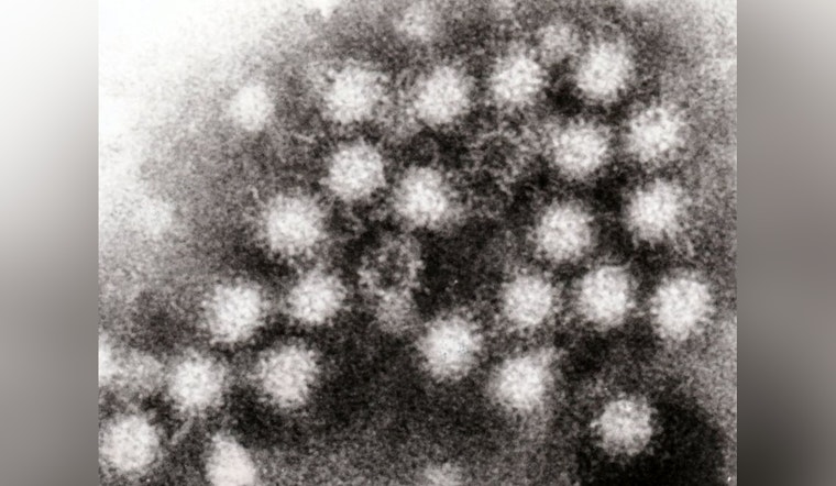 Milwaukee Battles Surge in Respiratory Illnesses, Norovirus and Whooping Cough Add to Winter Health Concerns