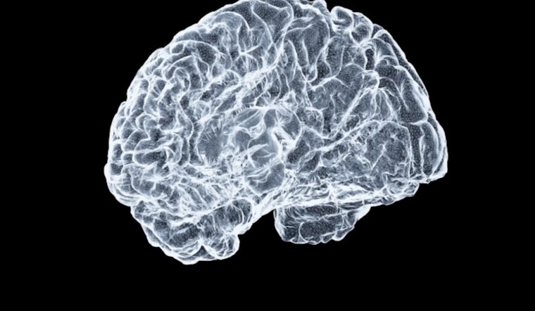 MIT Brainiacs Crack Code of Memory Storage, Placing Memories Mapped in Revolutionary Study