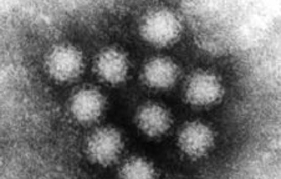 Norovirus Outbreak Strikes Pasadena Evacuation Shelter Following Wildfires