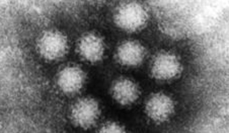 Norovirus Outbreak Strikes Pasadena Evacuation Shelter Following Wildfires