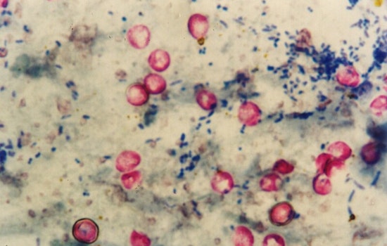 Portland Water Bureau Detects Cryptosporidium in City's Drinking Source, Precautions Advised for Compromised Immune Systems