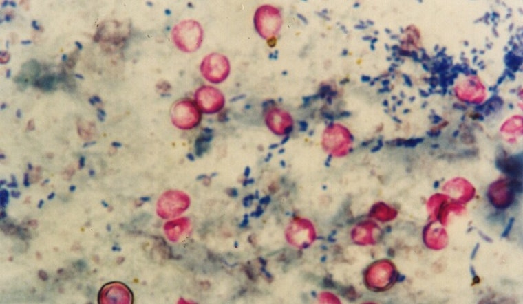 Portland Water Bureau Detects Cryptosporidium in City's Drinking Source, Precautions Advised for Compromised Immune Systems