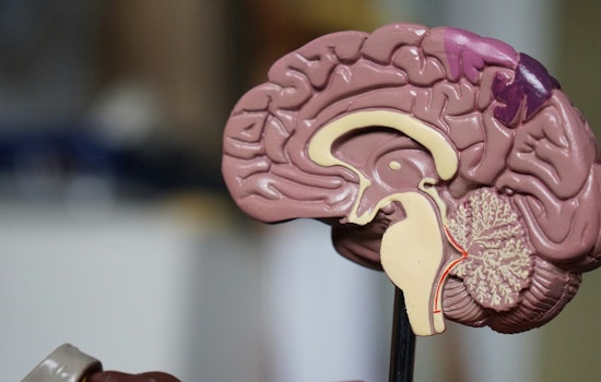 Study Warns Dementia Cases in U.S. to Double by 2060, Arizona Tops Growth Rate for Alzheimer's