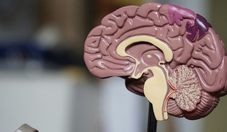 Study Warns Dementia Cases in U.S. to Double by 2060, Arizona Tops Growth Rate for Alzheimer's