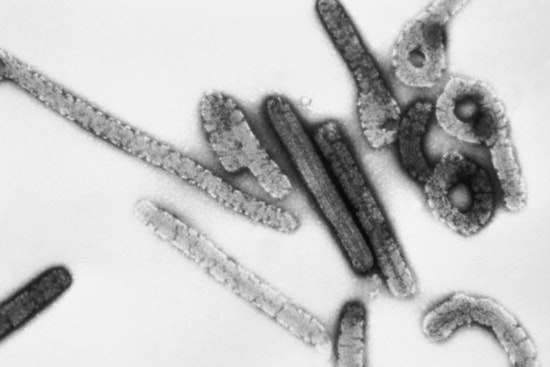 Texas Lab Announces Oral Drug Breakthrough with 80% Survival Rate in Marburg Virus Battle
