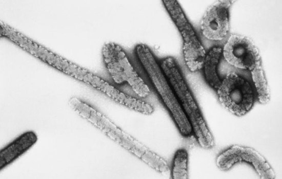 Texas Lab Announces Oral Drug Breakthrough with 80% Survival Rate in Marburg Virus Battle