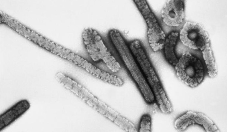 Texas Lab Announces Oral Drug Breakthrough with 80% Survival Rate in Marburg Virus Battle