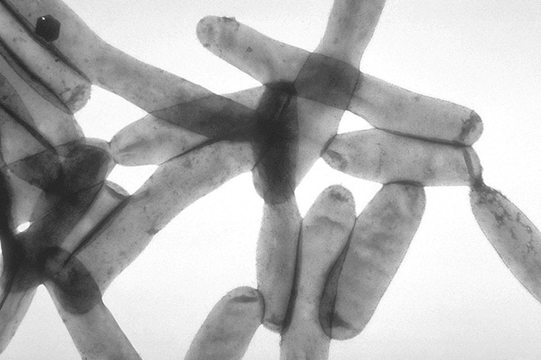 Bloomingdale Nursing Home Linked to Legionnaires' Disease Cases, Illinois Health Officials Issue Alert
