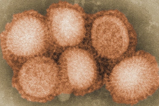 First Case of Avian Influenza Confirmed in Wallowa County, Oregon; State Officials Enact Quarantine and Cull Infected Flock