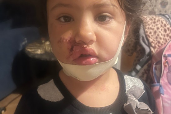 Mentor Mother and 4-Year-Old Daughter Recovering After Vicious Dog Attack, Three Dogs Euthanized