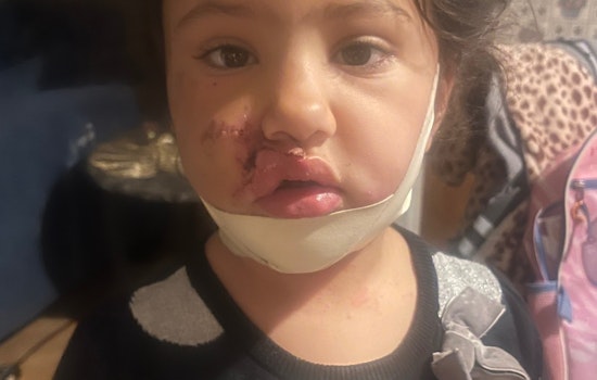 Mentor Mother and 4-Year-Old Daughter Recovering After Vicious Dog Attack, Three Dogs Euthanized
