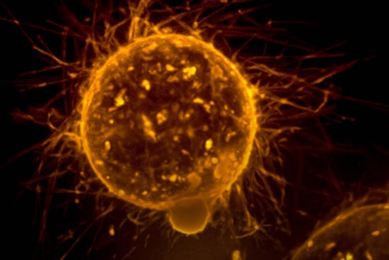 MIT and Harvard Medics Unleash Revolutionary CAR-NK Cells to Battle Cancer with Precision