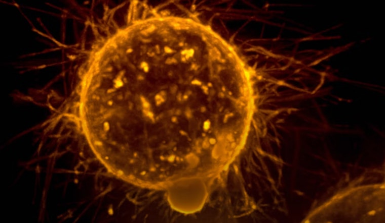 MIT and Harvard Medics Unleash Revolutionary CAR-NK Cells to Battle Cancer with Precision