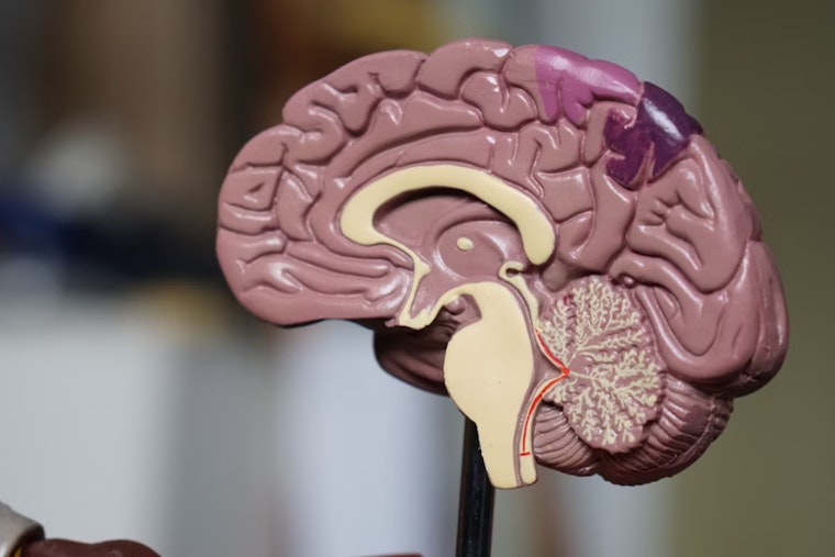 MIT Launches Rare Brain Disorders Nexus, Aiming for Breakthroughs in Rare Disease Research