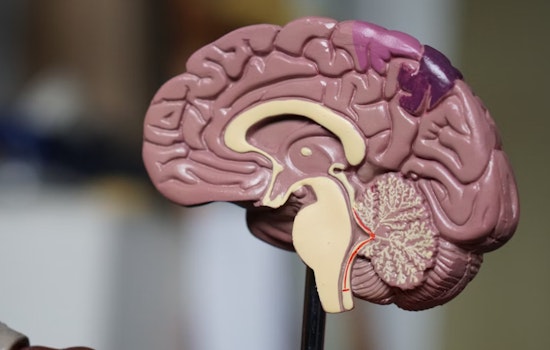 MIT Launches Rare Brain Disorders Nexus, Aiming for Breakthroughs in Rare Disease Research