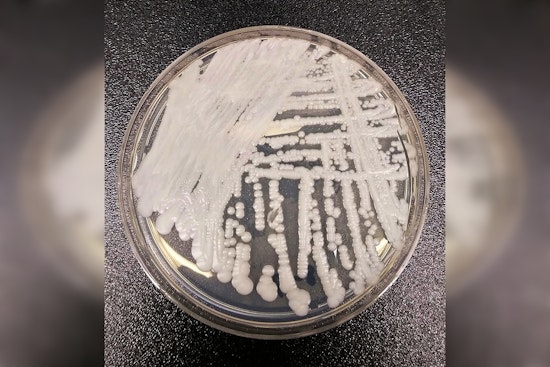 Drug-Resistant 'Super Yeast' Creeps Through Chicago Hospitals