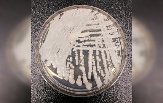 Drug-Resistant 'Super Yeast' Creeps Through Chicago Hospitals
