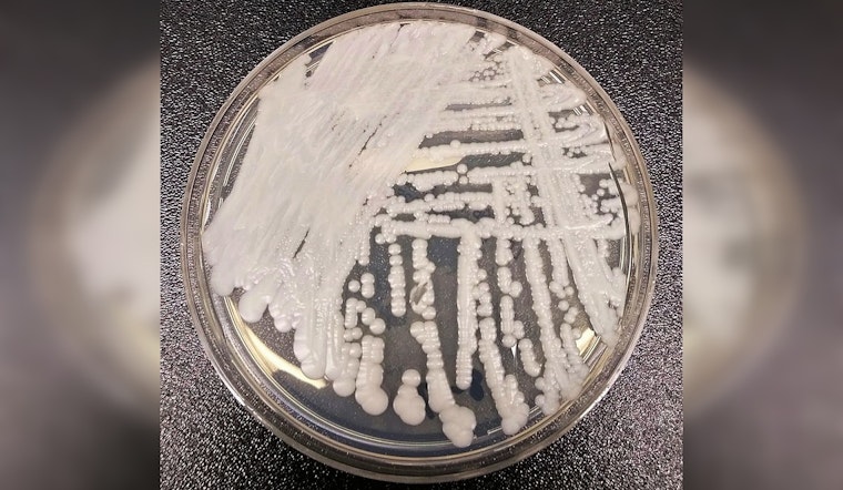 Drug-Resistant 'Super Yeast' Creeps Through Chicago Hospitals
