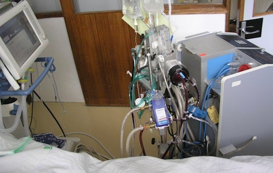 Long Island Father's Life Saved by ECMO Machine After Pneumonia Complication at South Shore University Hospital