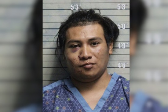 Man Faces Felony Charges After DUI Leads to Serious Injury Collision in Butler County