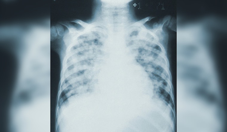 Mayor Bowser and DC Health Amplify Efforts for Early Lung Cancer Detection and Prevention in Washington, DC