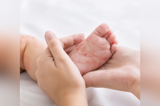 Measles Exposure Alert for Flagstaff Mall Visitors on November 6th, Health Officials Advise Vigilance