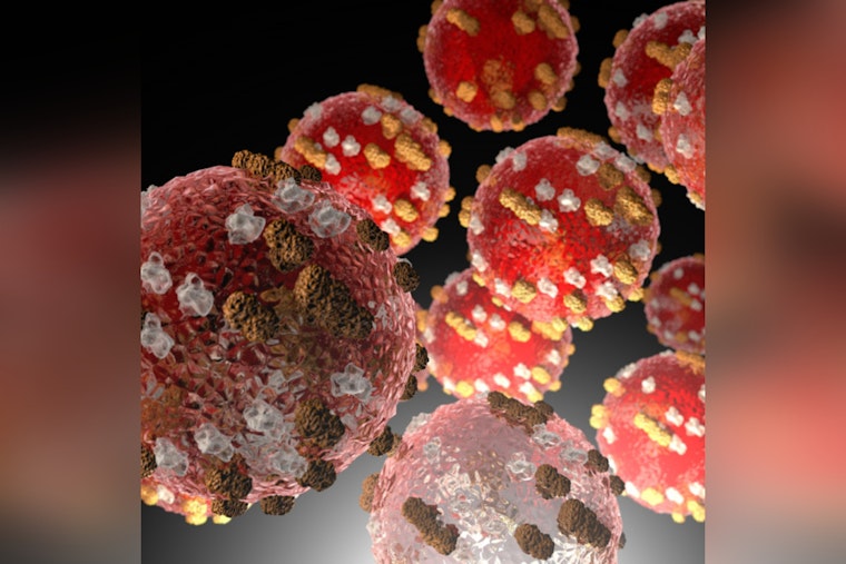 Measles Exposure Alert in Maricopa County: Visitor Diagnosed, Public Advised to Monitor Health after Potential Contact at Local Hotel and Concert Venue