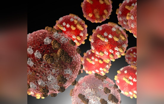 Measles Exposure Alert in Maricopa County: Visitor Diagnosed, Public Advised to Monitor Health after Potential Contact at Local Hotel and Concert Venue
