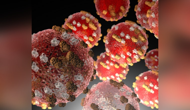 Measles Exposure Alert in Maricopa County: Visitor Diagnosed, Public Advised to Monitor Health after Potential Contact at Local Hotel and Concert Venue