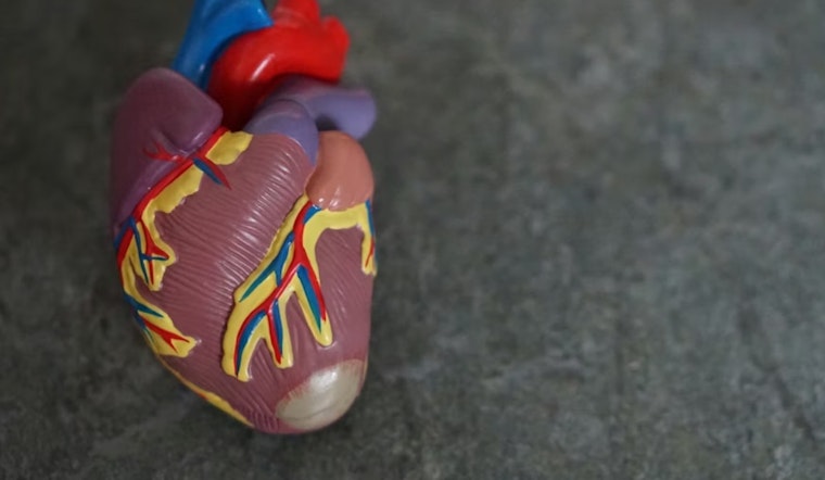 Palo Alto VA Performs First VHA Transcatheter Tricuspid Replacement