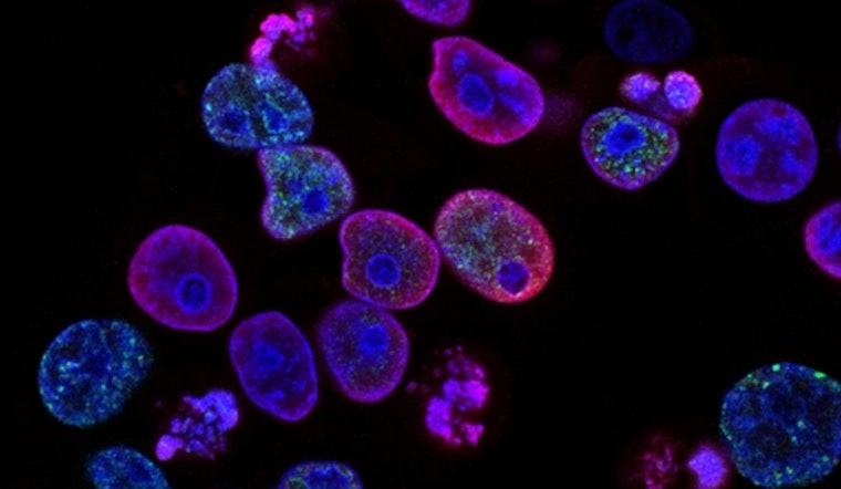 Dallas Lab Nails Culprit Protein Behind Explosive Cell Death