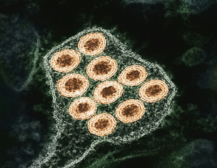 Rabies Alert in Buford: Gwinnett County Confirms Infected Coyote After Multiple Attacks