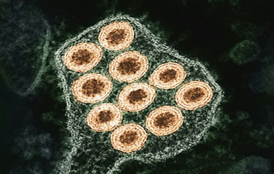 Rabies Alert in Buford: Gwinnett County Confirms Infected Coyote After Multiple Attacks