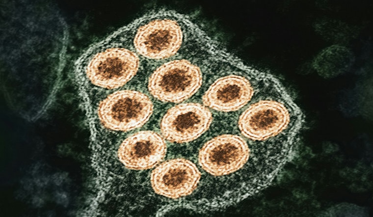 Rabies Alert in Buford: Gwinnett County Confirms Infected Coyote After Multiple Attacks