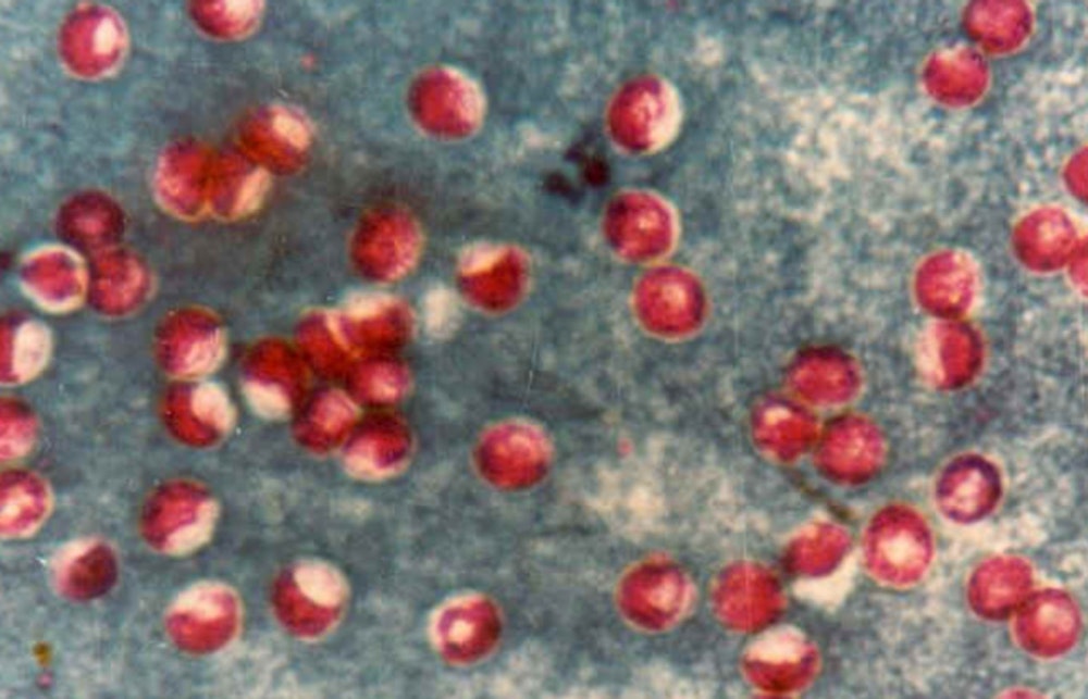 Portland Water Bureau Detects Cryptosporidium in Bull Run Watershed, Vigilance Advised for Immunocompromised Residents