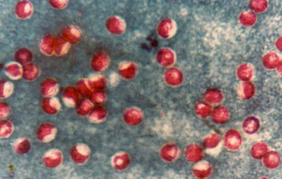 Portland Water Bureau Detects Cryptosporidium in Bull Run Watershed, Vigilance Advised for Immunocompromised Residents