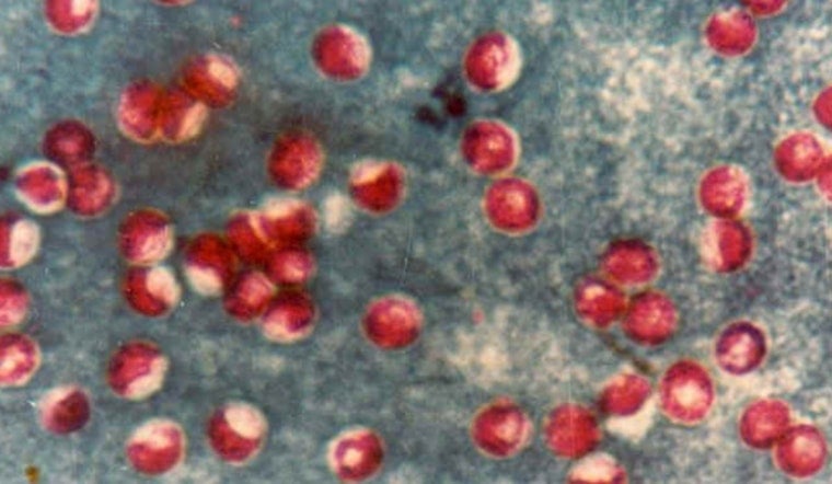 Portland Water Bureau Detects Cryptosporidium in Bull Run Watershed, Vigilance Advised for Immunocompromised Residents