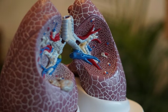 University of Cincinnati Nephrologists Report Promising Advances in Treatment Guidelines for Kidney Diseases