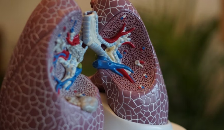 University of Cincinnati Nephrologists Report Promising Advances in Treatment Guidelines for Kidney Diseases