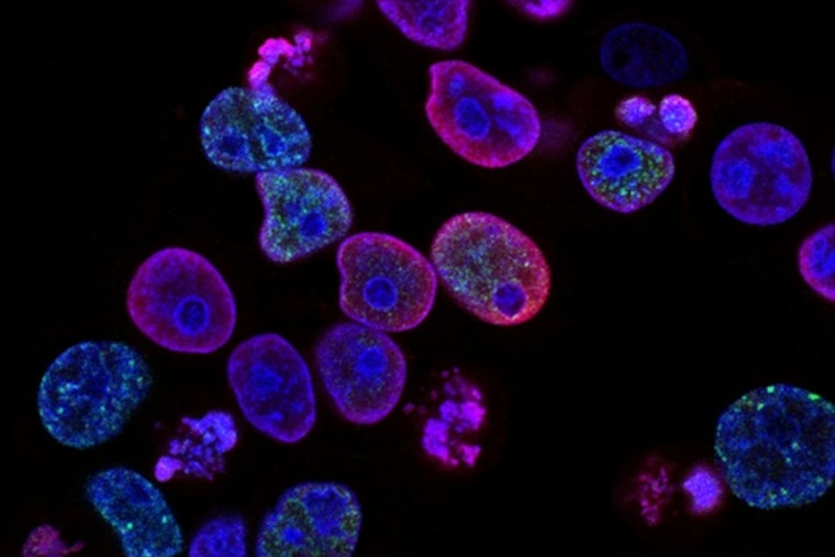 University of Cincinnati Unveils Promising Blood Cancer Treatments at National Hematology Meeting in Orlando