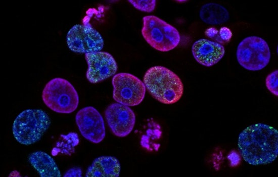 University of Cincinnati Unveils Promising Blood Cancer Treatments at National Hematology Meeting in Orlando