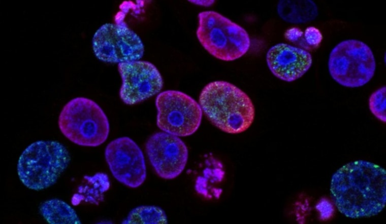 University of Cincinnati Unveils Promising Blood Cancer Treatments at National Hematology Meeting in Orlando
