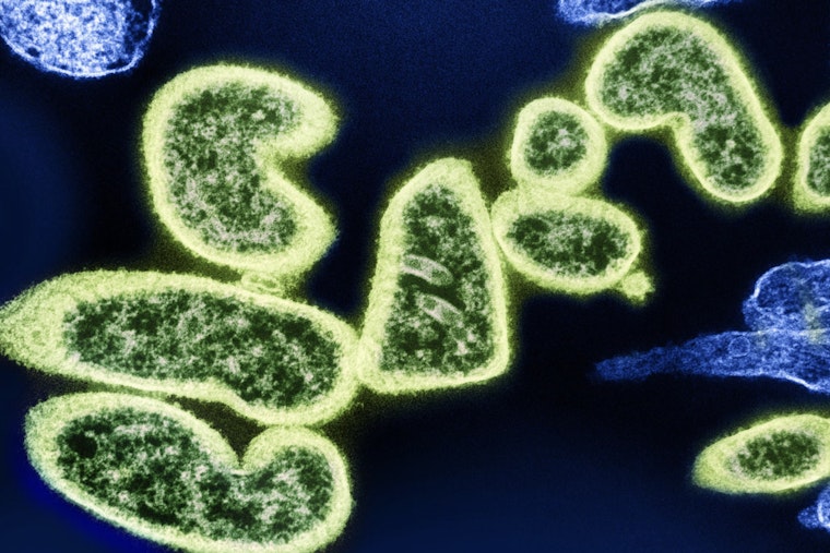 UWM Professor Troy Skwor Champions Innovative Light Therapies to Combat Global Superbug Threat