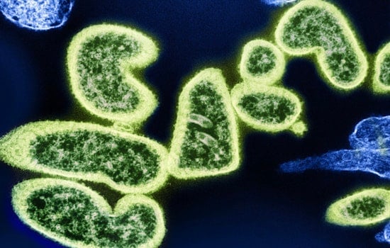 UWM Professor Troy Skwor Champions Innovative Light Therapies to Combat Global Superbug Threat
