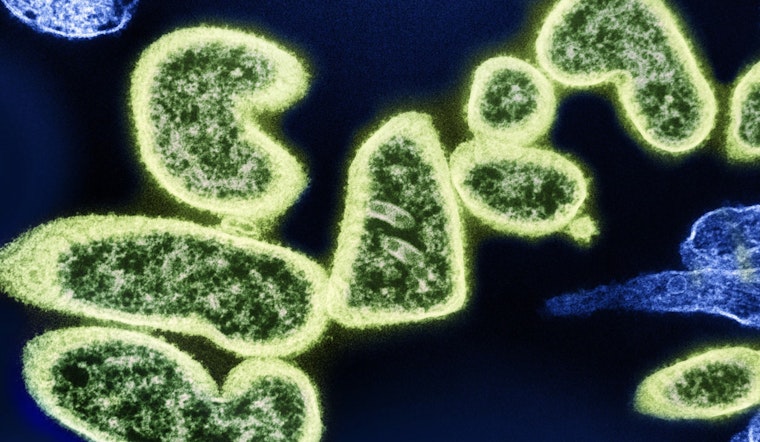 UWM Professor Troy Skwor Champions Innovative Light Therapies to Combat Global Superbug Threat